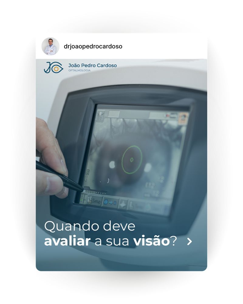 Post Instagram: Macro fotografia de íris humana
